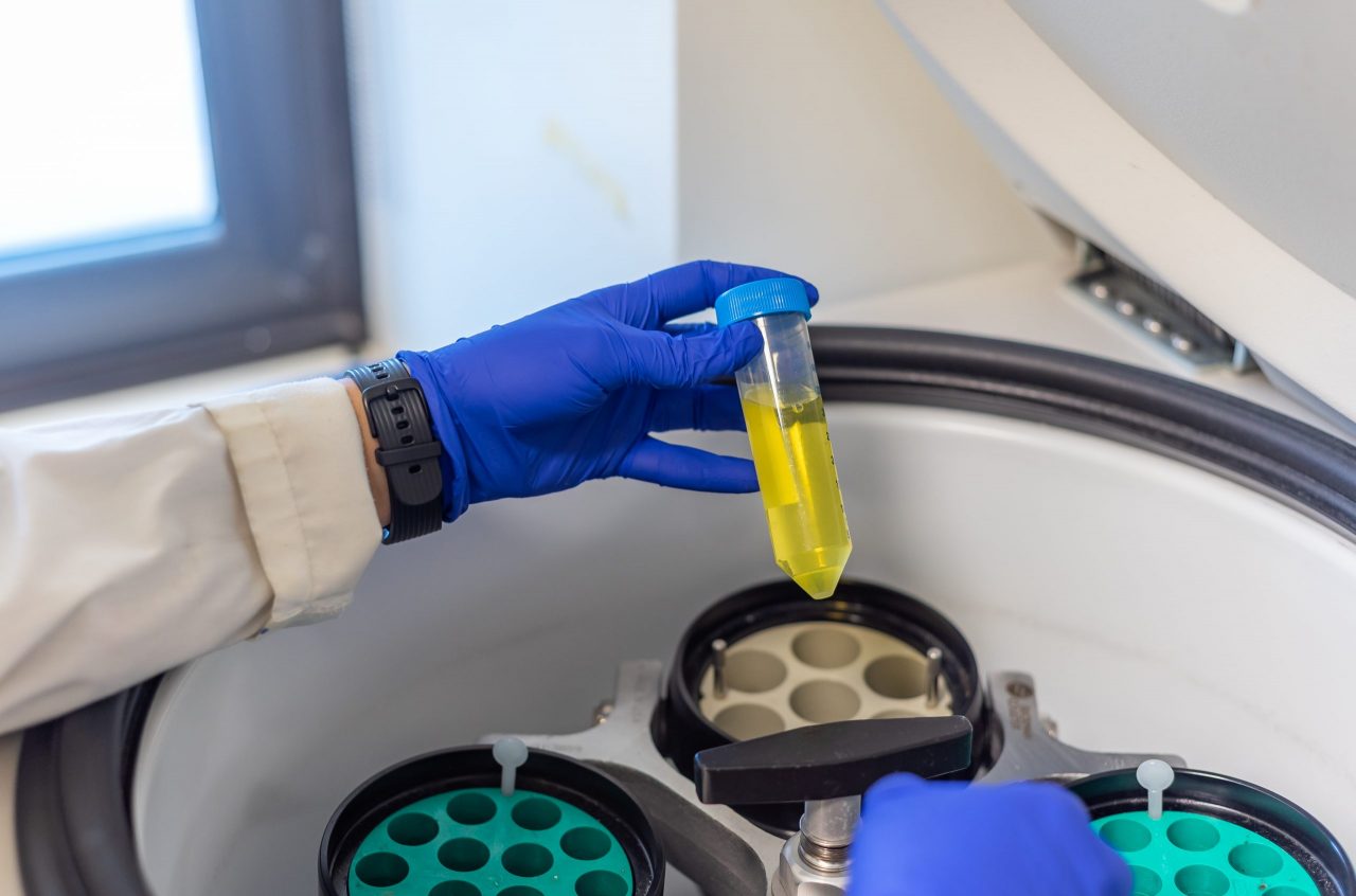 What is a centrifuge? Kalstein