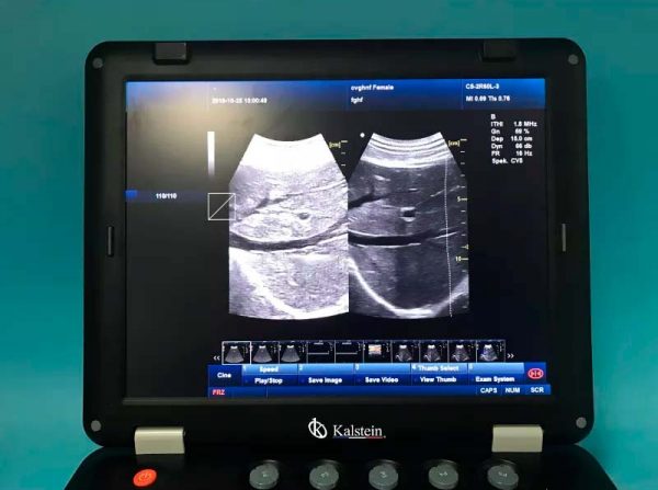 128 Item 3D Medical THI Ultrasound Machine For Sale With Convex Probe YR05148 - Image 3