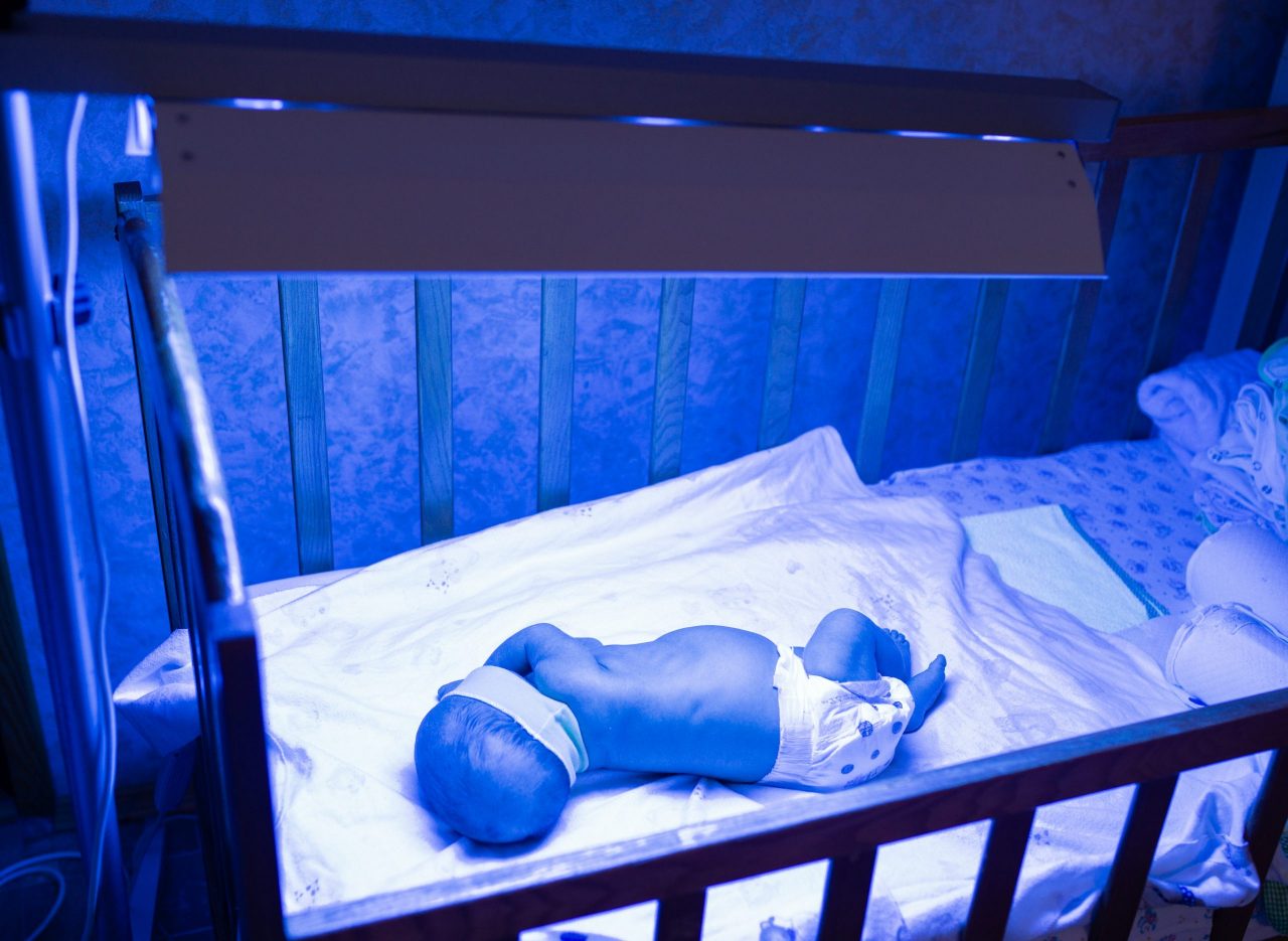 How does an infant bilirubin phototherapy unit work?  Kalstein