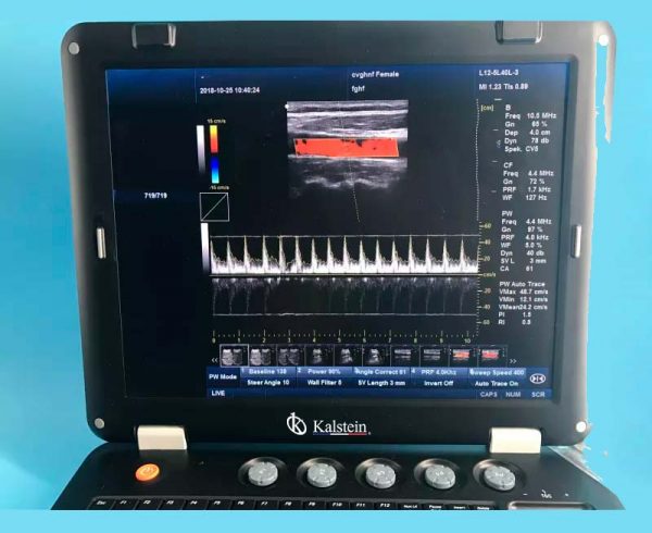 Machine médicale d'ultrason de l'article 128 THI 3D à vendre avec la sonde convexe YR05148 – Image 2